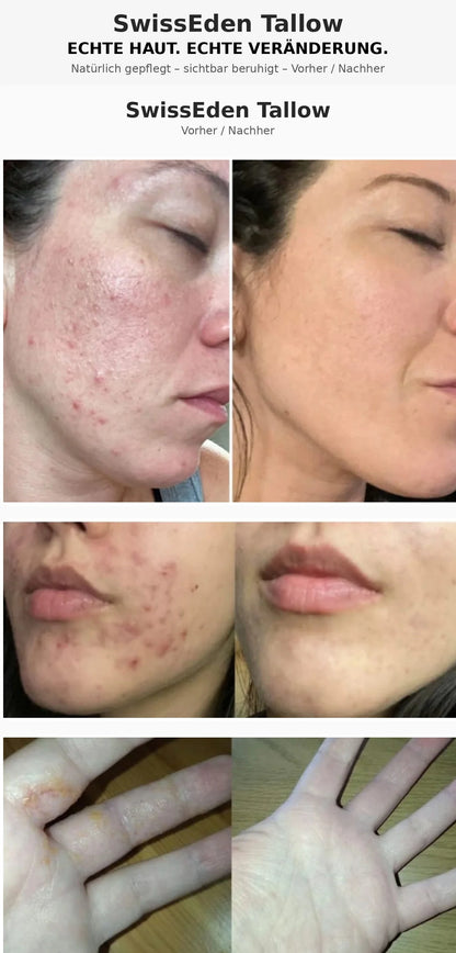 Kundenbilder und Pflege-Erfahrungen mit Swiss Eden Tallow Pure.