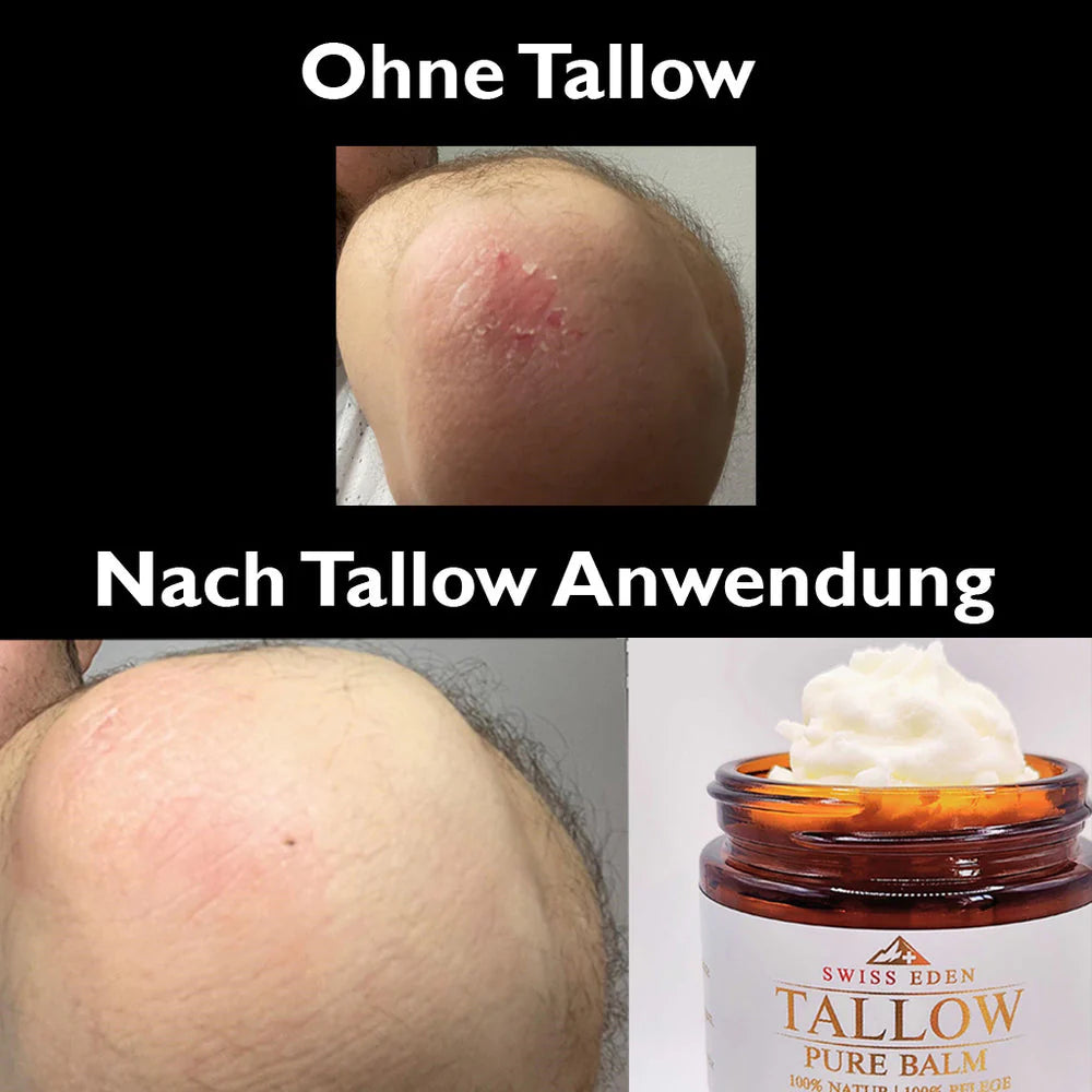 Kundenerfahrung mit Swiss Eden Tallow Balm bei trockener und beanspruchter Haut